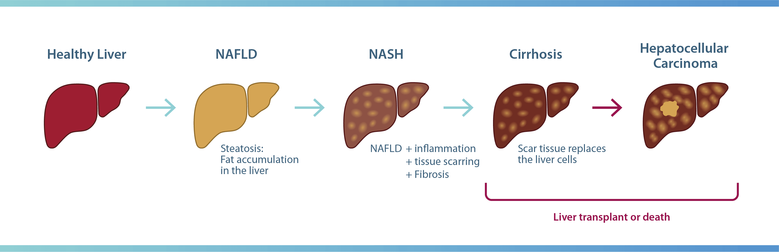 Disease Modelling of the Liver | CN BIO Innovations