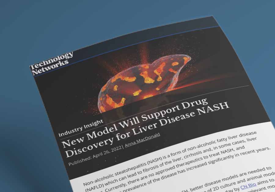 Resource image of New Model Will Support Drug Discovery for Liver Disease NASH