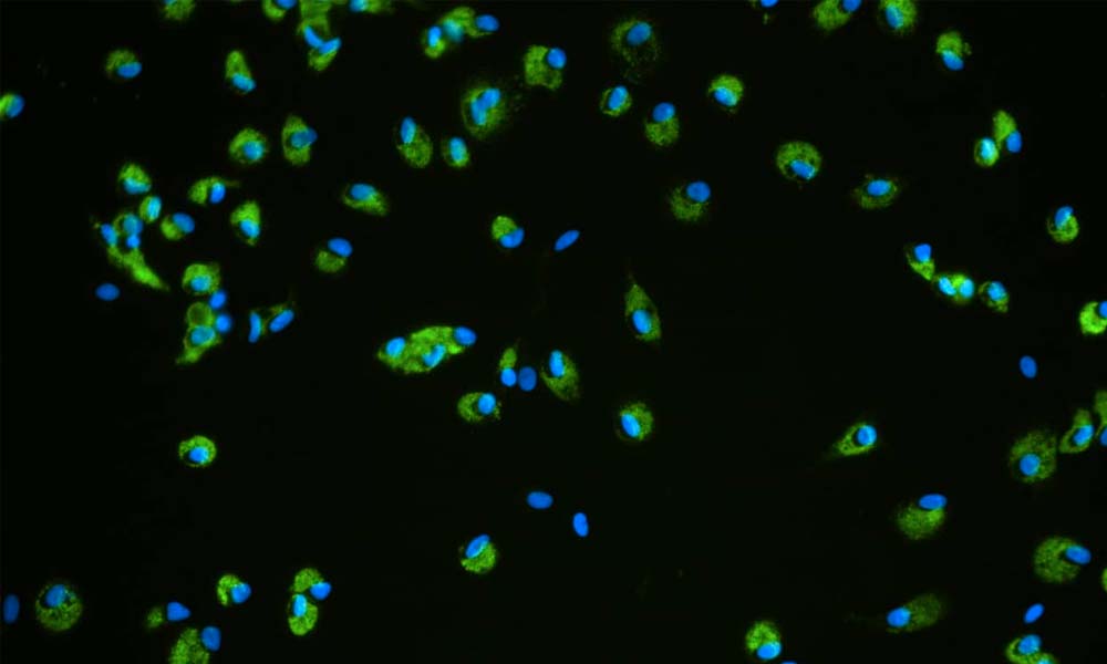 cnb789 dili blog cell tissue |