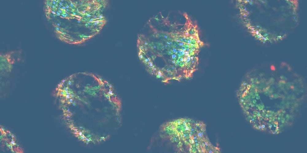 Confocal images of human liver microtissues from the PhysioMimix® DILI assay that deliver mechanistic toxicity insights