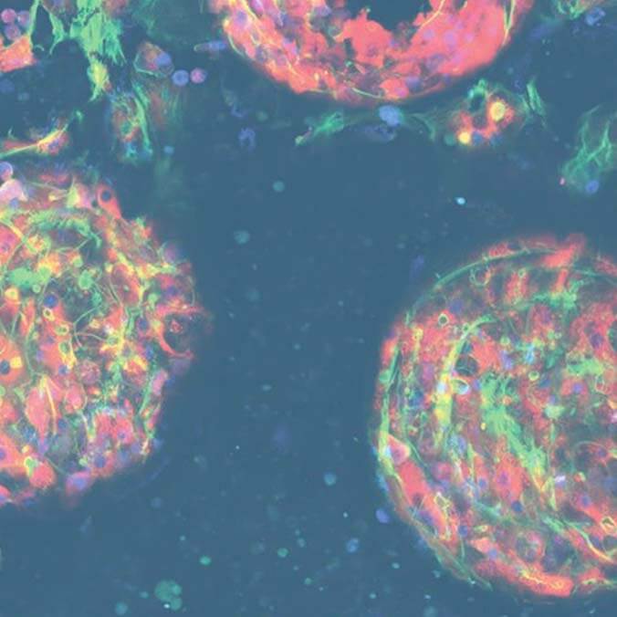 Image of Liver microtissues for drug metabolism studies cultured by PhysioMimix Core