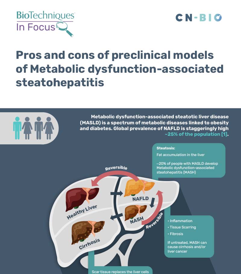 cnb1666 mash infographic v1 | Metabolic dysfunction-associated steatohepatitis